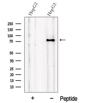 Polyclonal Rabbit anti-Human PCSK9 Antibody (IF, WB)
