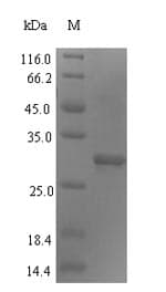 Human ERCC5 / XPG Protein (Recombinant 6His, N-terminus)