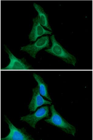 CANX / Calnexin Antibody (clone AT18B9)
