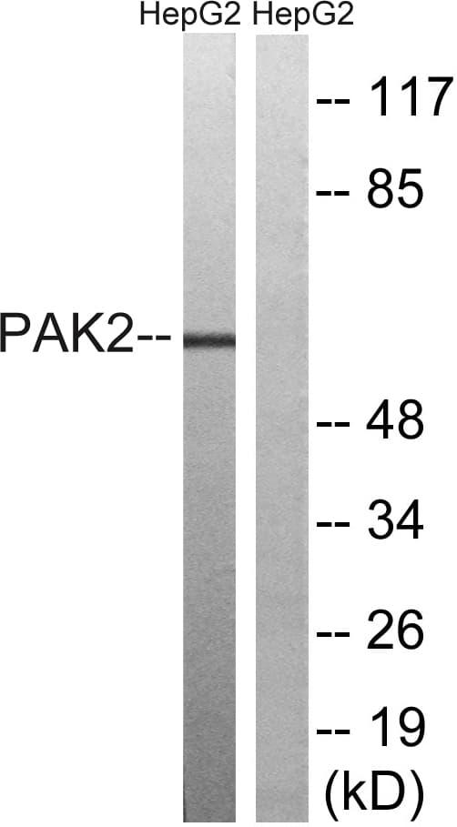 Polyclonal Rabbit anti-Human PAK2 Antibody (aa158-207, WB)