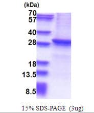 Human SIRT1 / Sirtuin 1 Protein (Recombinant His)