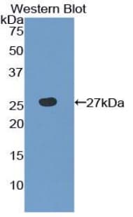 TLR6 Antibody (aa608-796, HRP)