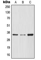 NFKBIA / IKB Alpha / IKBA Antibody (N-Terminus)