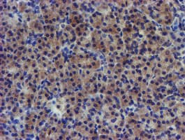 PDSS2 / DLP1 Antibody (clone OTI1C11)