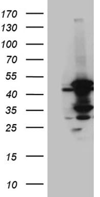 Monoclonal Mouse anti-Human MCAD / ACADM Antibody (clone OTI9G10, Carrier-free, IHC, WB)