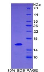 Mouse CD27L / CD70 Protein (Recombinant 6His, N-terminus)