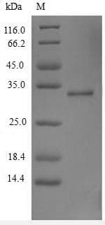 Human TSLP Protein (Recombinant 6His-SUMO, N-terminus)