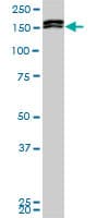 MLLT10 Antibody (clone 6H8)