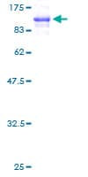 Human FLNA / Filamin A Protein (Recombinant GST)
