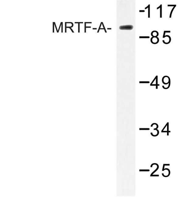 BSAC / MKL1 Antibody (His11)
