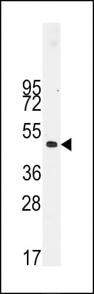 DES / Desmin Antibody (Thr16)