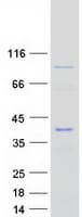 Human EPSTI1 Protein (Recombinant Myc-DDK (Flag))
