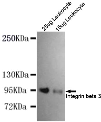 Monoclonal Mouse anti-Human ITGB3 / Integrin Beta 3 / CD61 Antibody (WB)