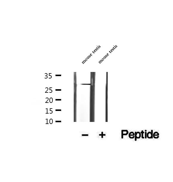 Polyclonal Rabbit anti-Human GSTM3 Antibody (IHC, WB)