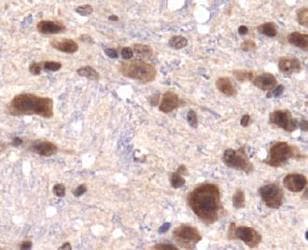KDM3A / JMJD1A Antibody (aa250-400)