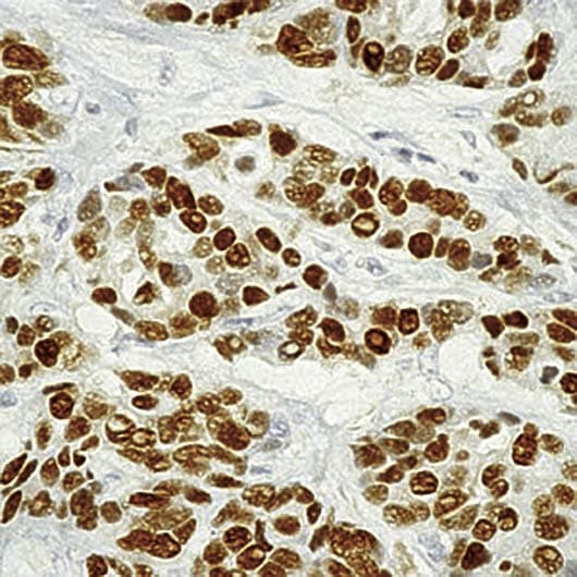 PathPlus™ ER Alpha / Estrogen Receptor Antibody (clone 6F11)