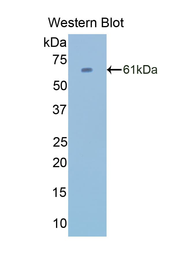 CAT / Catalase Antibody (aa246-366)