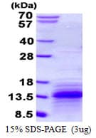Mouse CCL3 / MIP-1-Alpha Protein (Recombinant His)