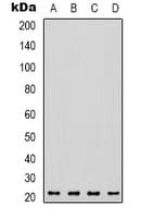 Polyclonal Rabbit anti-Human VEGFA / VEGF Antibody (Internal, WB)