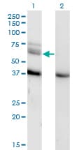 MAP3K7 / TAK1 Antibody (clone 3C9)