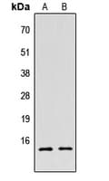 Histone H2B Antibody (Acetyl-Lys5)
