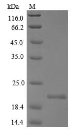 Mouse MCA32 Protein (Recombinant 10His, N-terminus + Myc, C-terminus)