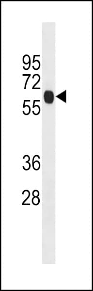 Polyclonal Rabbit anti-Human ENO4 Antibody (aa388-414, WB)