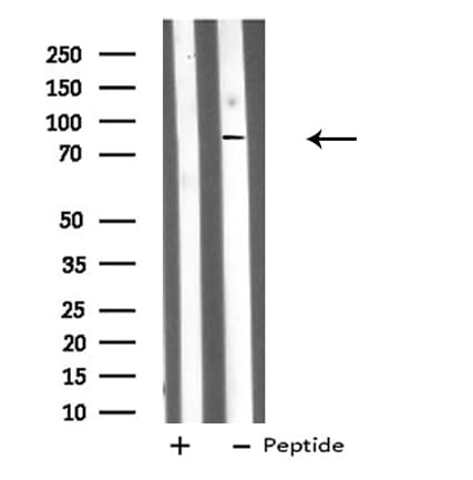 Polyclonal Rabbit anti-Human DDX50 Antibody (WB)