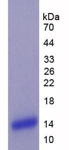 Human PLXNB1 / Plexin-B1 Protein (Recombinant His)