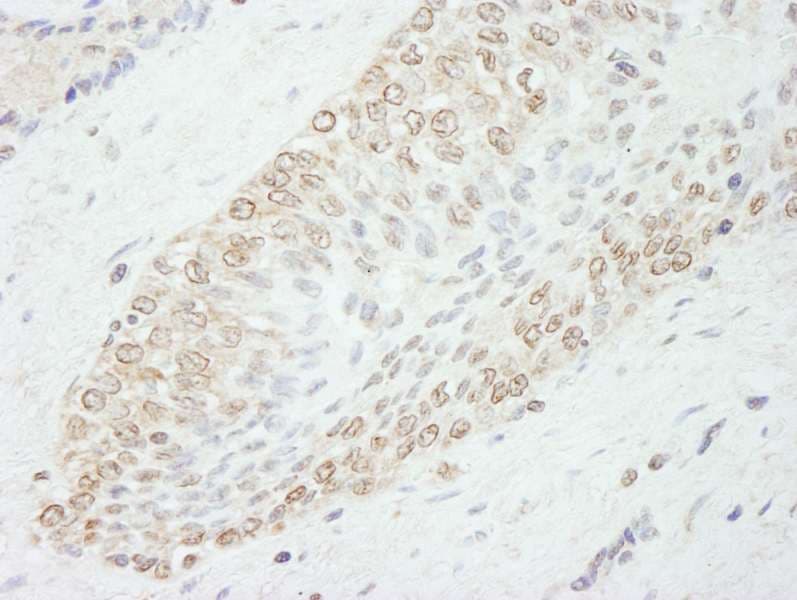 WDR91 Antibody (aa250-300)