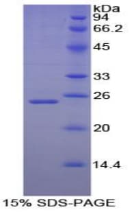 Dog NOG / Noggin Protein (Recombinant His)