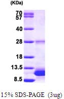 Human S100B / S100 Beta Protein (Recombinant His)