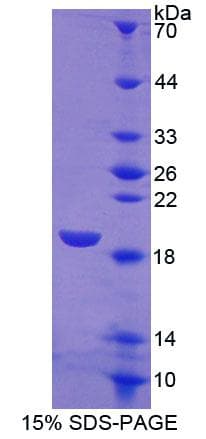 Human SIGLEC7 / CD328 Protein (Recombinant His-S)