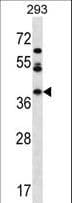KSP32 / MIOX Antibody (aa1-30)