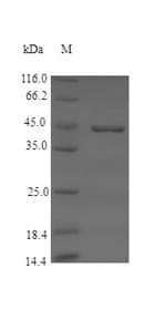 Pig F12 / Factor XII Protein (Recombinant 6His, N-terminus)
