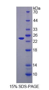 Mouse LEPR / Leptin Receptor Protein (Recombinant His-S)