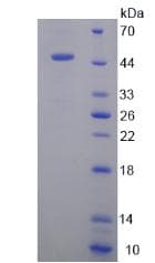 Mouse PPARA / PPAR Alpha Protein (Recombinant His-GST)