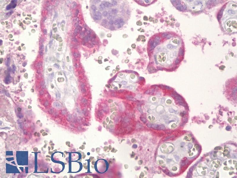 IHC-plus™ CGB / hCG Beta Antibody (aa101-150)