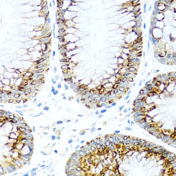 CCL2 / MCP1 Antibody