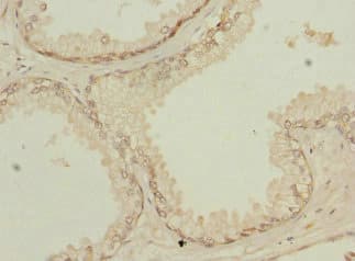 Polyclonal Rabbit anti-Human NMT2 Antibody (IHC, WB)