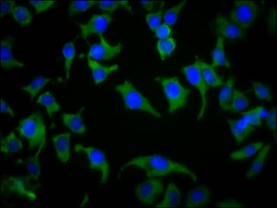 Polyclonal Rabbit anti-Human SPPL2B Antibody (IF)