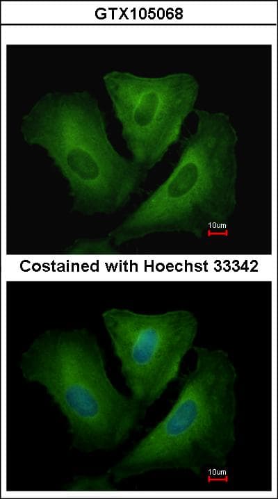Polyclonal Rabbit anti-Human HLA-DRB3 Antibody (aa4-266)