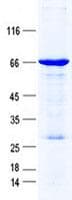 Human DLX3 Protein (Recombinant GST, N-terminus + His, C-terminus)