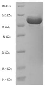 Rhizobium meliloti lpsL Protein (Recombinant 6His-SUMO, N-terminus)
