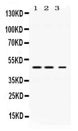 Polyclonal Rabbit anti-Human PLIN3 / M6PRBP1 / TIP47 Antibody (IHC, WB)