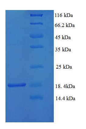 Cynomolgus monkey TTR / Transthyretin Protein (Recombinant 6His, N-terminus)