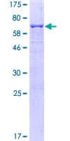 Human CD95 / FAS Protein (Recombinant GST)