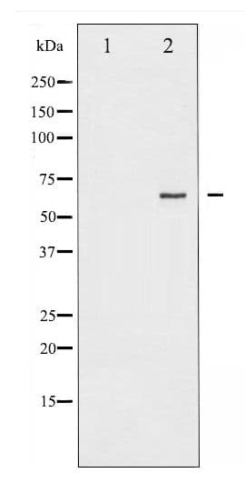 RELA / NFKB p65 Antibody