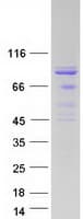 Human ADRBK1 / GRK2 Protein (Recombinant Myc-DDK (Flag))