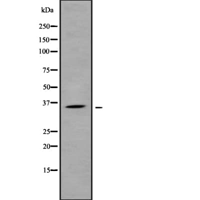 Polyclonal Rabbit anti-Human SFRP1 Antibody (WB)